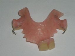 Partial